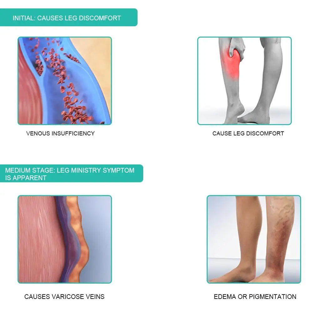 1 paar Medizinische Kompressio – Compression Sock Medical Bewertung und Preis