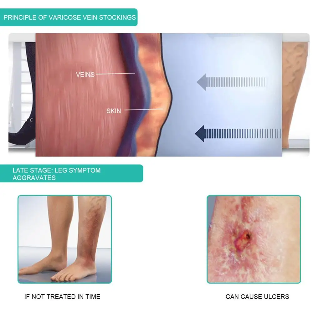 1 paar Medizinische Kompressio – Compression Sock Medical Bewertung und Preis